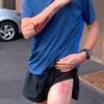 Trail running fall on Bear Peak: Why do accidents happen?