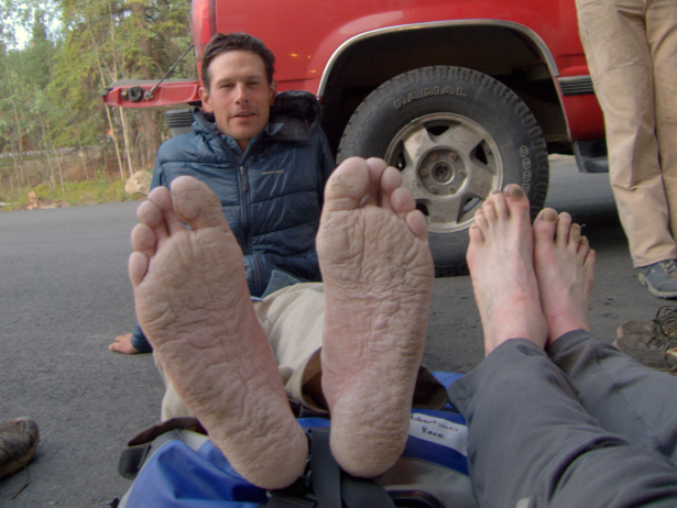 Badly macerated feet after the Alaska Mountain Wilderness Classic